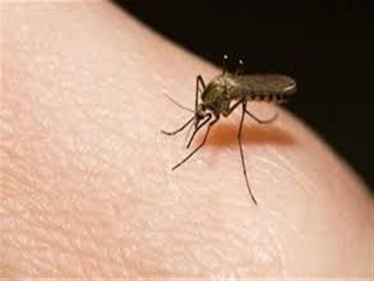 25d8 25ad 25d9 2584 25d9 2585  25d8 25ad 25d8 25b4 25d8 25b1 25d8 25a7 25d8 25aa  25d8 25b9 25d9 2584 25d9 2589  25d8 25ac 25d8 25b3 25d9 2585 25d9 258a1849816607.jpg6646db3cb670f1849816607